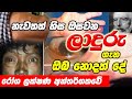 What is Leprosy | ලාදුරු රෝගය යනු කුමක්ද? | රෝගලක්ෂණ | ලාදුරු | Sinhala