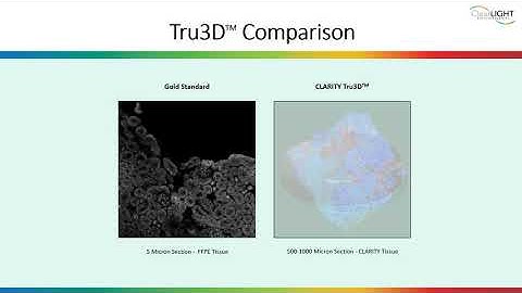 Why Choose 3D Imaging Over Standard 2D?