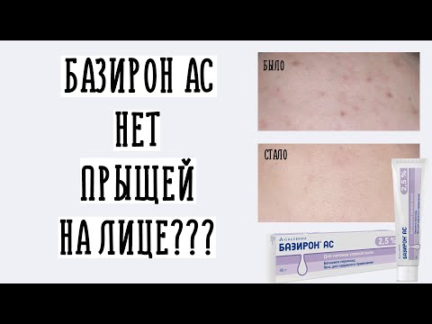 Базирон АС нет прыщей на лице? | Как избавиться от прыщей в домашних условиях?