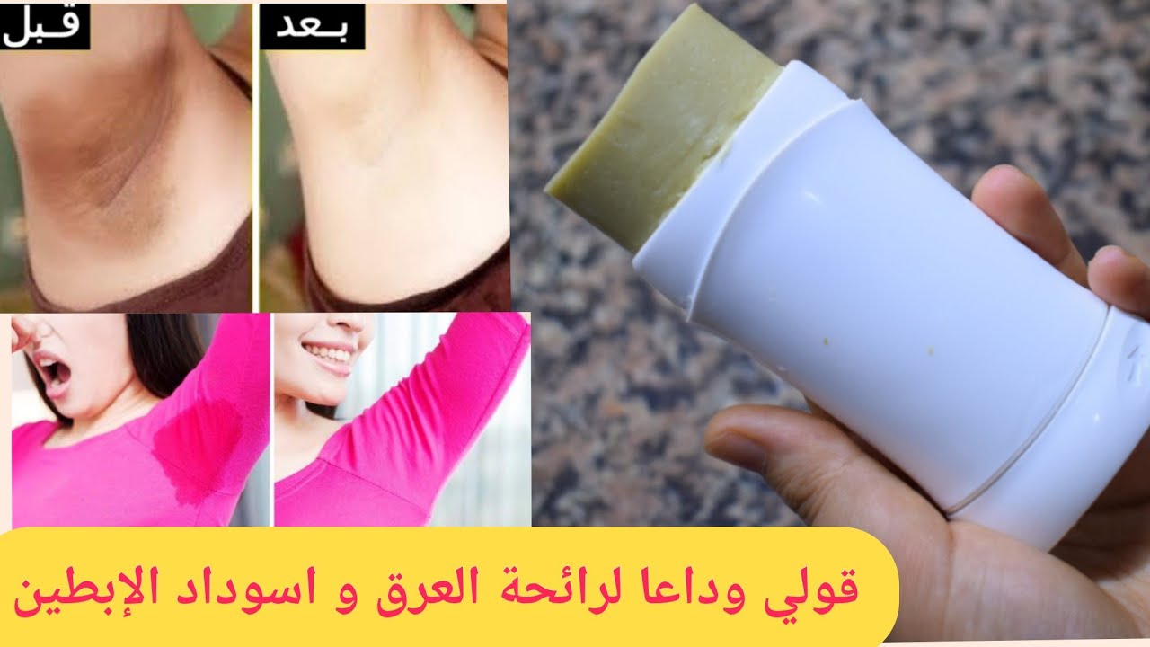 مزيل عرق طبيعي للتخلص من رائحة العرق و اسوداد الإبطين بدون المنيوم و لا مواد مسرطنة Youtube