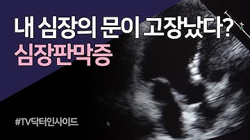 심장판막증 / TV닥터인사이드 부산MBC 20191125 방송