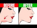 How to Get Rid of a Double Chin