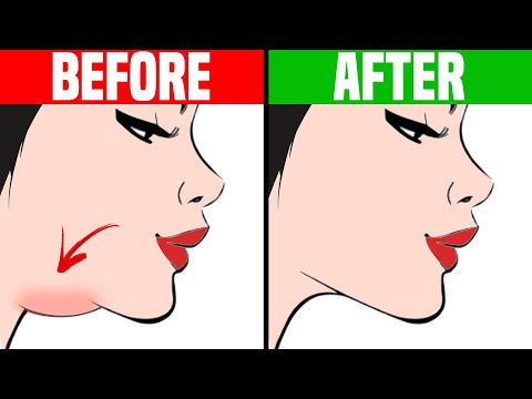 Video: How To Remove A Double Chin At Home In A Week