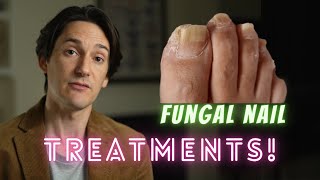 Fungal Nail Treatments