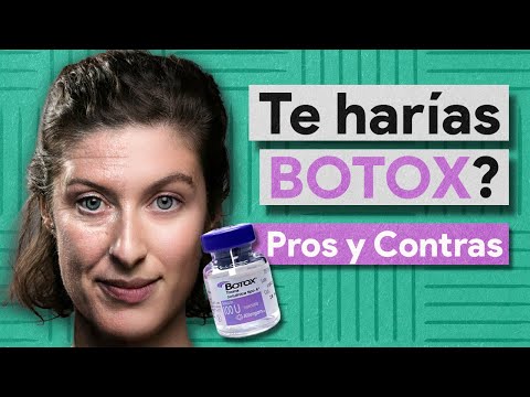 Todo sobre el