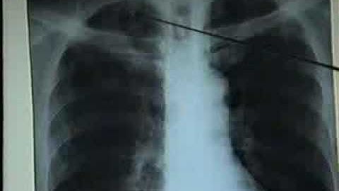 02 CoUcDonChum[bacsihoasung.wordpress.com].wmv