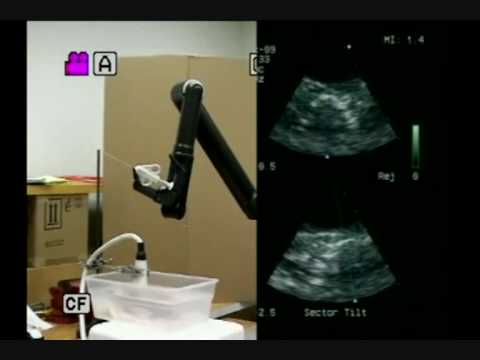 Duke robot biopsy guided by 3D ultrasound
