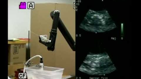 Duke robot biopsy guided by 3D ultrasound