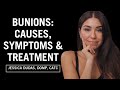 How to Treat Bunions without Surgery (Exercises & Treatment)