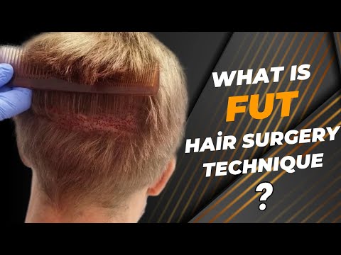 WHAT IS FUT