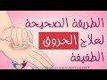 الطريقة الصحيحة لعلاج الحروق في المنزل