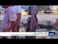 مركز الملك سلمان يوزع مساعدات إيوائية للمتضررين من الحريق في مخيم نشطون للنازحين