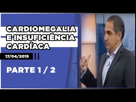 Vídeo: Coração Aumentado (cardiomegalia): Causas, Tratamento E Muito Mais