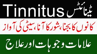 kan ka bajna shor awaz ana | Tinnitus causes symptoms and treatment in urdu