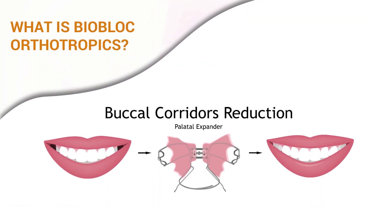 Holistic Dentistry What is Biobloc Orthotropics? YouTube