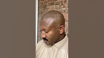 Scalp Micropigmentation is the future hairloss solutions