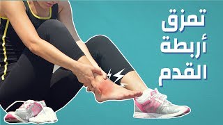 تمزق اربطة القدم #موضوع