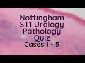 Urology Pathology Quiz Cases 1 - 5 ST1 2021