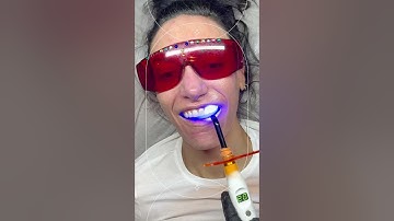 Tooth gem application video