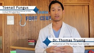 How to Get Rid of Toenail Fungus Effectively