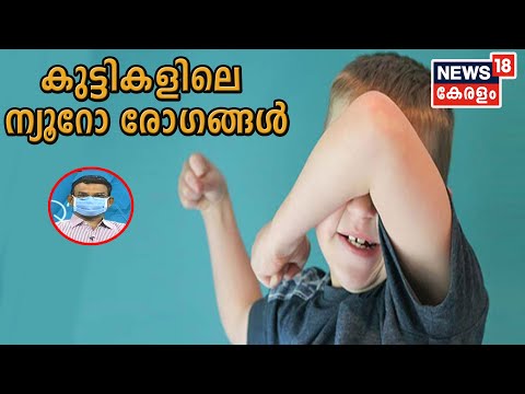 Dr  Q: കുട്ടികളിലെ ന്യൂറോ രോഗങ്ങള്‍ | Neurological Disorders In Children | 10th July 2020