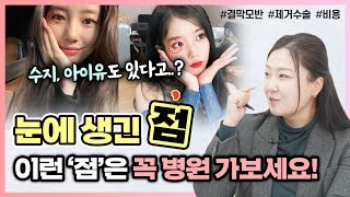 👀갑자기 눈동자에 생긴 &#39;점&#39;...?😨 결막모반 원인, 수술, 비용, 통증 | 안과의사가 알려드려요! - [나는의사다 1080회]