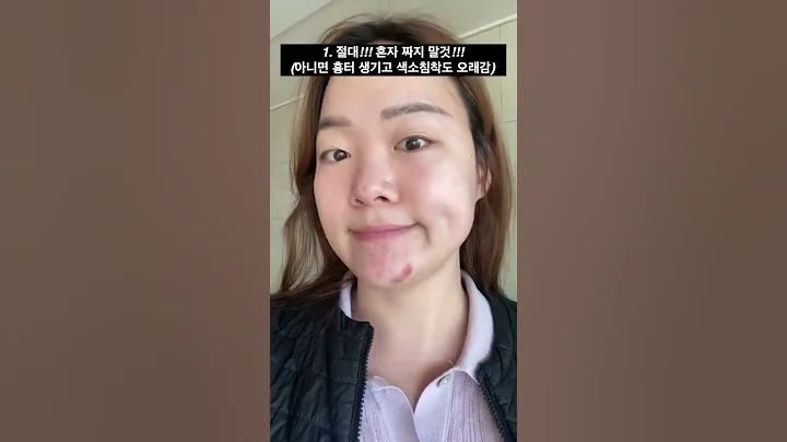 ❗Major Do's & Dont's when you have MASSIVE hormonal acne