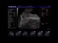 Understanding the Placenta - YouTube