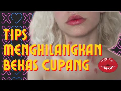 TIPS AND TRICKS PRAKTEK MENGHILANGKAN BEKAS CUPANG #CUPANG #KISS