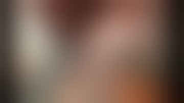 Robotic Left Upper Lobe Wedge Resection after LIMA Graft - Most Difficult