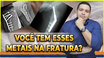Para que serve o pino na perna?