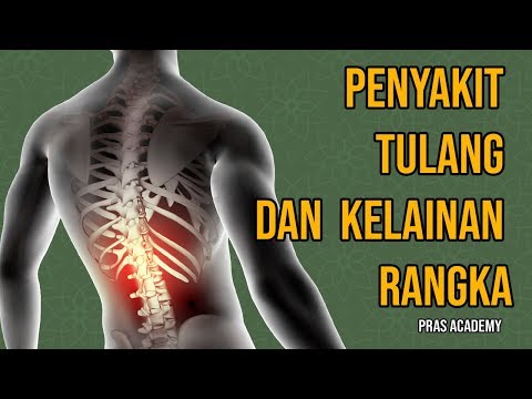 Penyakit tulang dan kelainan rangka manusia - IPA kelas 4 SD - Pras Academy