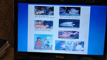 Class 12 Home Science| CBSE Home Science| Chapter 3 Home Science| Public Health Nutrition