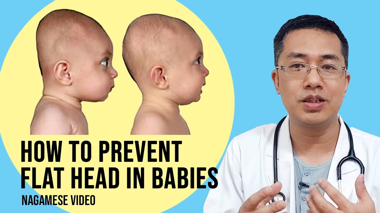 How to prevent flat head in babies Nagamese Video YouTube