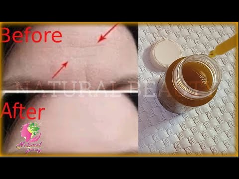 Unbelievable ! A Magical Oil! To Remove Mouth Wrinkles ,Under Eye Wrinkles And Forehead Wrinkles