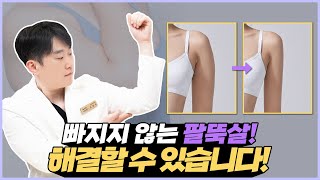 다이어트를 해도 그대로인 팔뚝살! 해결할 수 있다?🤔│팔뚝살 지방흡입 Q&amp;A✨