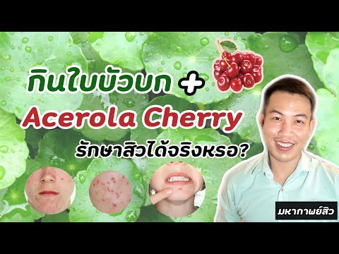 กินใบบัวบก กับ Acerola Cherry รักษาสิวได้จริงหรอ? | มหากาพย์สิว