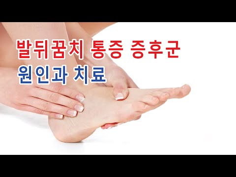 <strong>발뒤꿈치</strong> <strong>통증</strong> 증후군 치료를 위한 운동 5가지