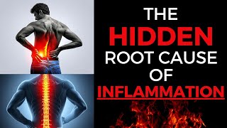 The Shocking TRUTH About Inflammation