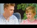 Growing Up With Tourette&#39;s Syndrome | Caspar Lee