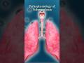 How TB Destroys Your Lungs🤯#medicaleducation