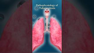 How TB Destroys Your Lungs🤯#medicaleducation