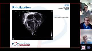 Coarctation & Interrupted Aortic Arch - Dr Fiona Willcoxson & Hannah Shaw