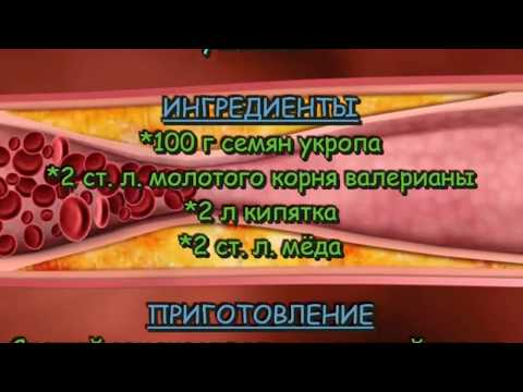 ✿Как очистить сосуды в домашних условиях.❤ Лучший народный метод!✿