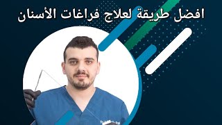 افضل طريقة لعلاج الفراغات بين الأسنان