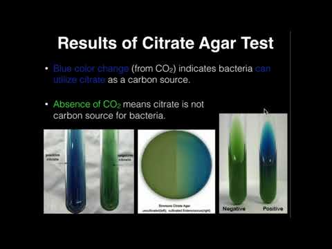 Microbiology: Citrate Agar