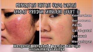 MENGATASI IRITASI PADA WAJAH AKIBAT PRODUK SKINCARE by Naomi Natalie  40,586 views 9 months ago 8 minutes, 59 seconds