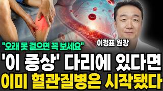 '이 증상' 다리에 있다면 이미 혈관질병은 시작됐다 (이정표 원장 / 2부)