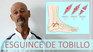 ¿Qué se siente cuando se rompe un ligamento del tobillo?