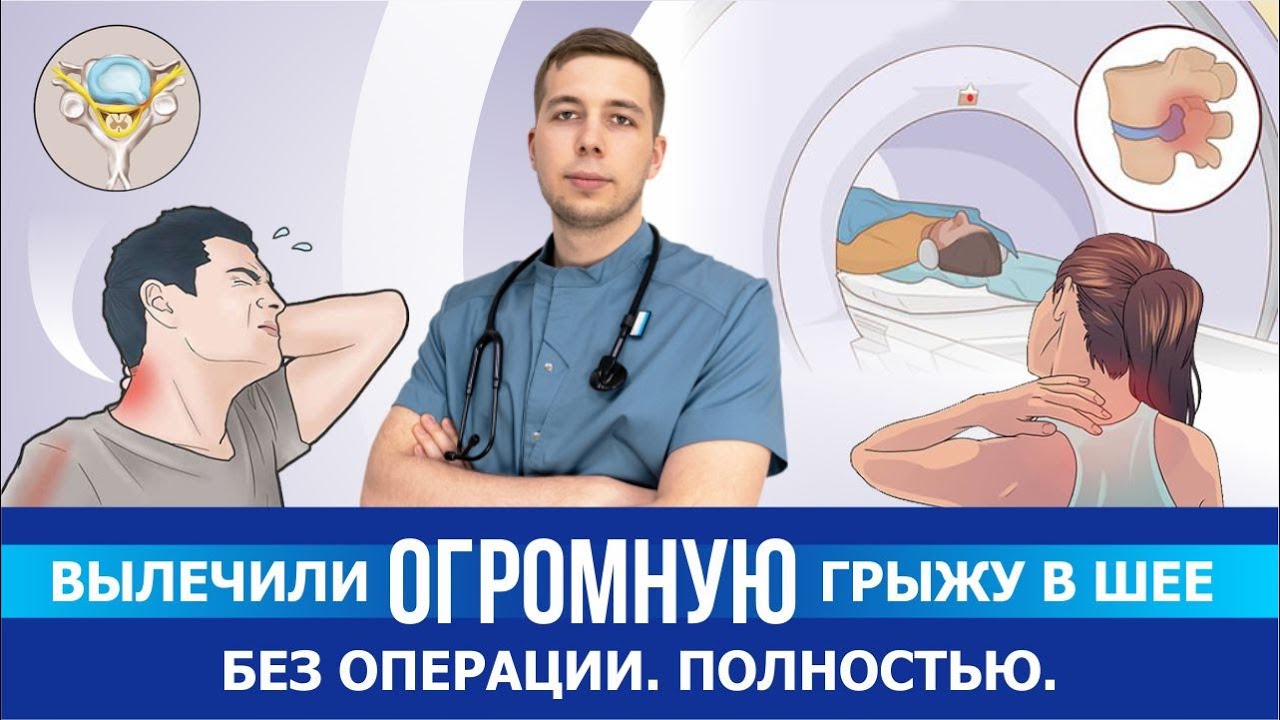 Вылечили ОГРОМНУЮ грыжу в шее без операции. Рассказываем как. Отзыв о резорбции в Смарт Клиник